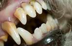 Les dents et l'hygine